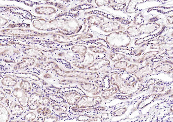 IDH1 Rabbit Polyclonal Antibody