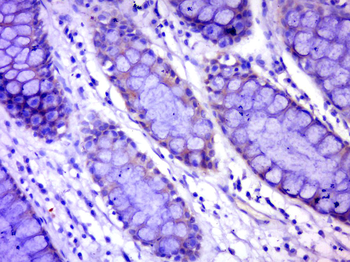 C17orf82 Rabbit Polyclonal Antibody