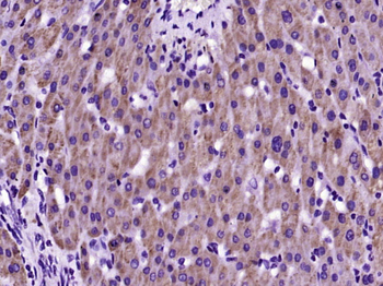 SARM1 Rabbit Polyclonal Antibody