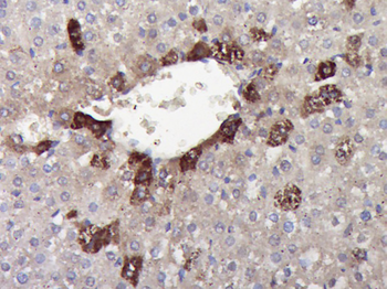HSPB7 Rabbit Polyclonal Antibody