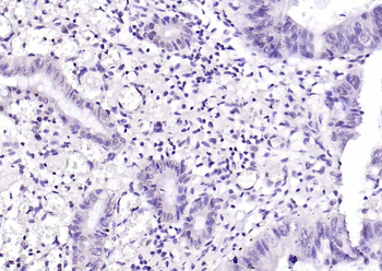 FIGNL1 Rabbit Polyclonal Antibody