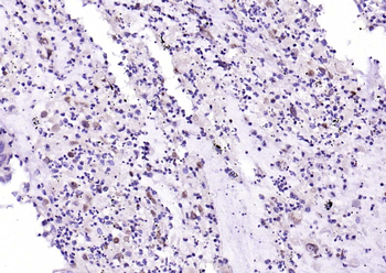 FIGNL1 Rabbit Polyclonal Antibody