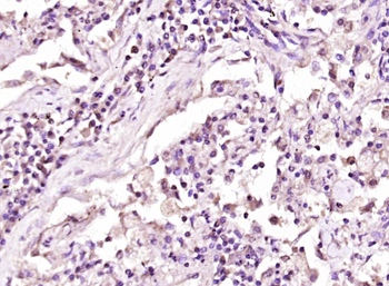 Phospho-Dishevelled 2 (Thr224) Rabbit Polyclonal Antibody