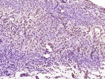 ERR-alpha Rabbit Polyclonal Antibody