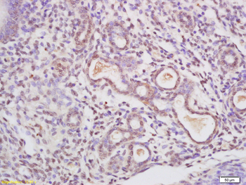 Nucleolin/C23 Rabbit Polyclonal Antibody
