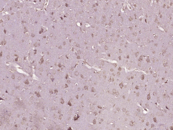 TSPAN5 Rabbit Polyclonal Antibody