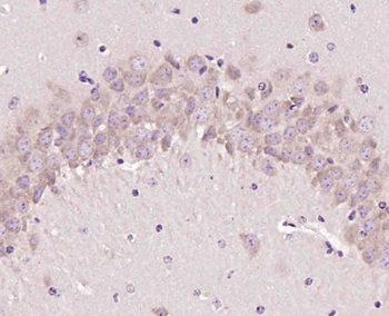 RNF31 Rabbit Polyclonal Antibody