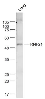 RNF21 Rabbit Polyclonal Antibody