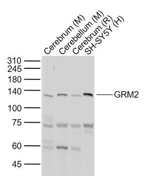 GRM2 Rabbit Polyclonal Antibody