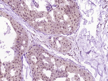 PRMT5 Rabbit Polyclonal Antibody