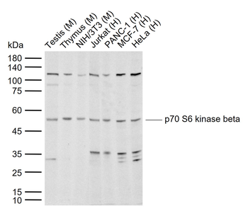 P70 S6 kinase beta Rabbit Polyclonal Antibody