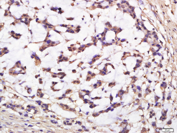 C1orf144 Rabbit Polyclonal Antibody