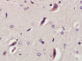 RNF213 Rabbit Polyclonal Antibody