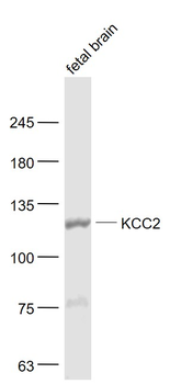 KCC2 Rabbit Polyclonal Antibody
