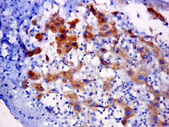 C5orf51 Rabbit Polyclonal Antibody