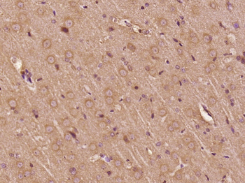 C21orf58 Rabbit Polyclonal Antibody