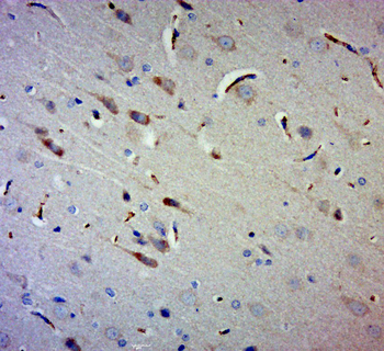 Gigaxonin Rabbit Polyclonal Antibody