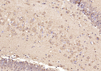 GRAMD2 Rabbit Polyclonal Antibody