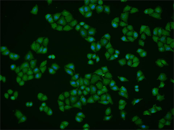 PIRH2 Rabbit Polyclonal Antibody