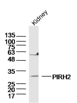 PIRH2 Rabbit Polyclonal Antibody