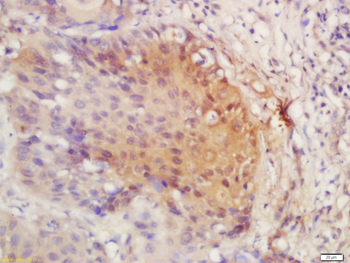 PIRH2 Rabbit Polyclonal Antibody