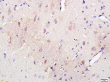 Spindly Rabbit Polyclonal Antibody
