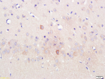Spindly Rabbit Polyclonal Antibody