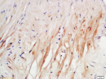 Elastin Rabbit Polyclonal Antibody