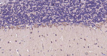 MAP1B Rabbit Polyclonal Antibody