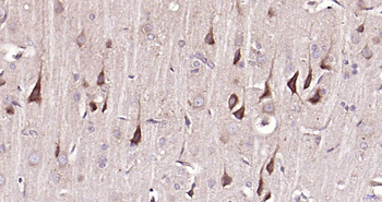 MAP1B Rabbit Polyclonal Antibody