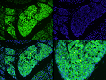 MAP1B Rabbit Polyclonal Antibody