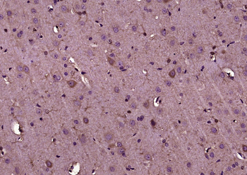 KIF5A/NKHC1 Rabbit Polyclonal Antibody