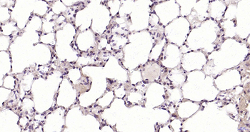 MSH3 Rabbit Polyclonal Antibody