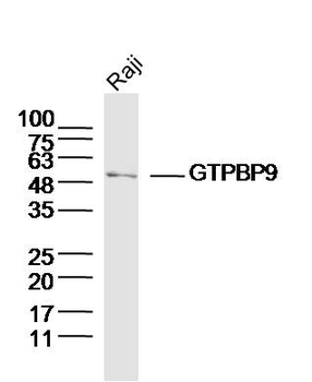 GTPBP9 Rabbit Polyclonal Antibody