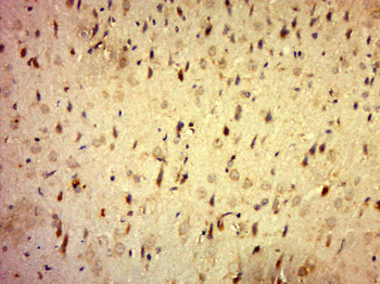 C20orf196 Rabbit Polyclonal Antibody