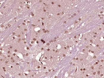 C20orf43 Rabbit Polyclonal Antibody
