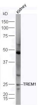 TREM1 Rabbit Polyclonal Antibody