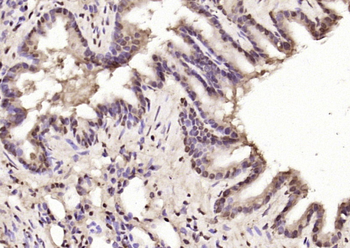 STAU2 Rabbit Polyclonal Antibody