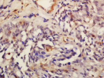 STAU2 Rabbit Polyclonal Antibody