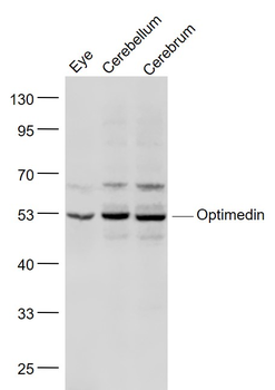 Optimedin Rabbit Polyclonal Antibody