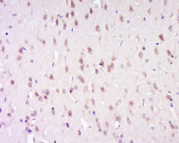 CNTN4/AXCAM Rabbit Polyclonal Antibody