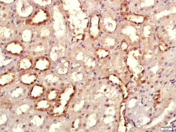 KRCC1 Rabbit Polyclonal Antibody