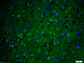 KIF1B Rabbit Polyclonal Antibody