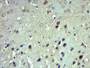 Angiotensin III Rabbit Polyclonal Antibody