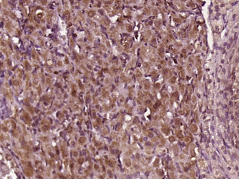 ADAMTS6 Rabbit Polyclonal Antibody