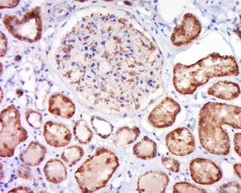 ALPPL2 Rabbit Polyclonal Antibody