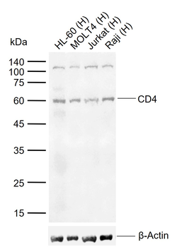 CD4 Rabbit Polyclonal Antibody