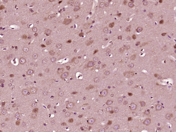 Collagen X Rabbit Polyclonal Antibody
