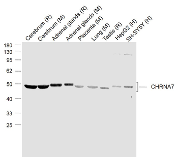 CHRNA7 Rabbit Polyclonal Antibody