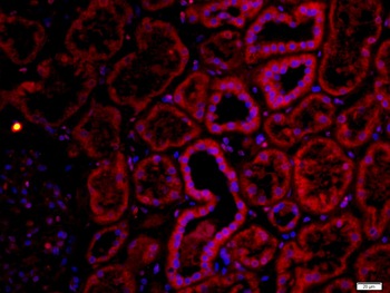 CHRNA7 Rabbit Polyclonal Antibody